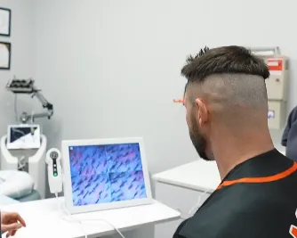 Healthy hair follicles harvested for FUE transplant at Revive Men's Hair Clinic