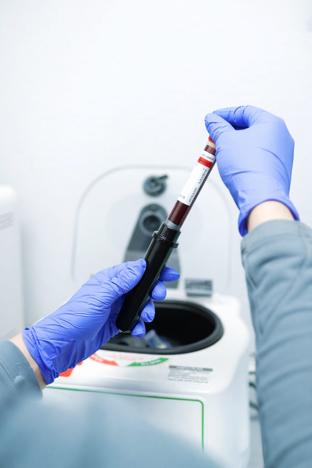 Gloved clinician placing a blood sample into a centrifuge for PRP preparation