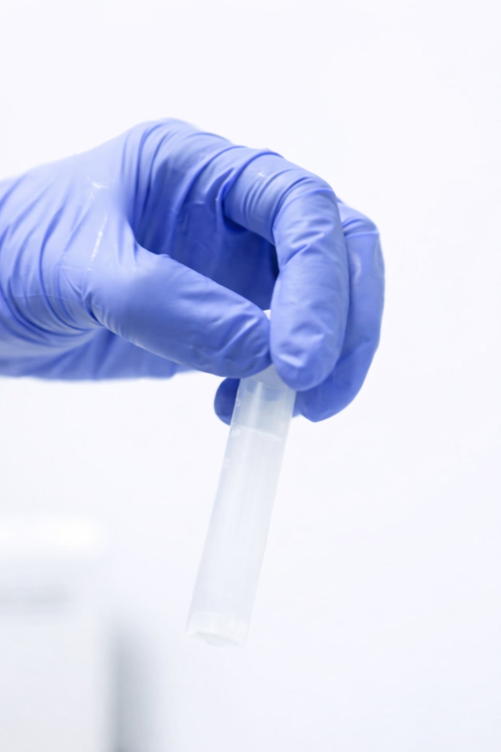 Gloved hand holding a laboratory sample vial prepared for Wharton s Jelly treatment